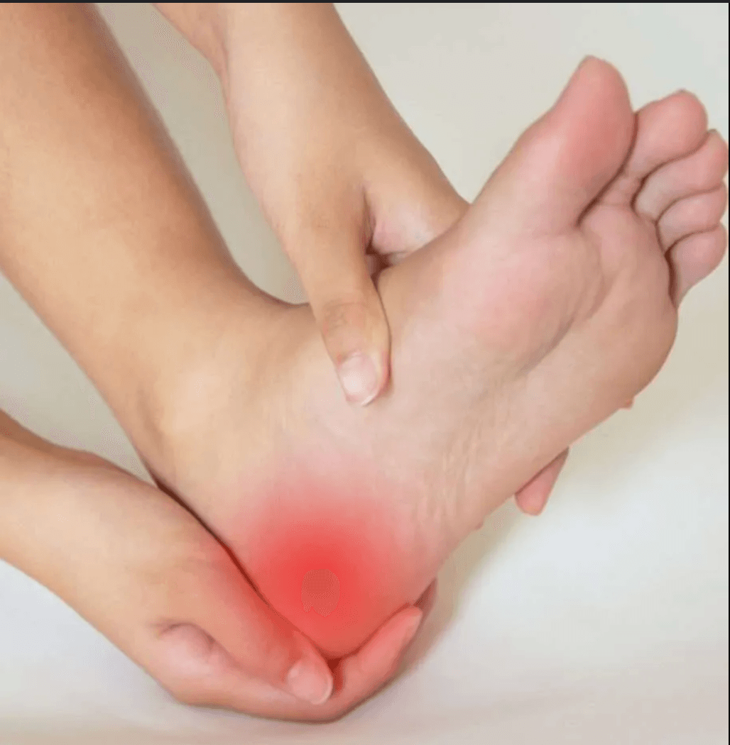 Heel pain treatment and foot anatomy